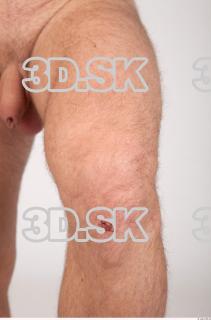 Knee texture of Vendelin 0002